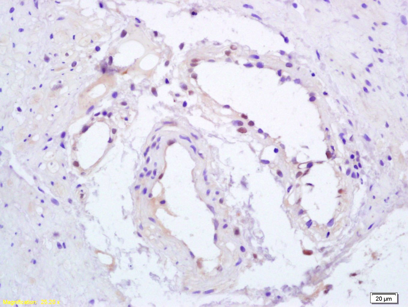 Anti-Phospho-PPAR gamma/PPARG (Ser112) Polyclonal Antibody