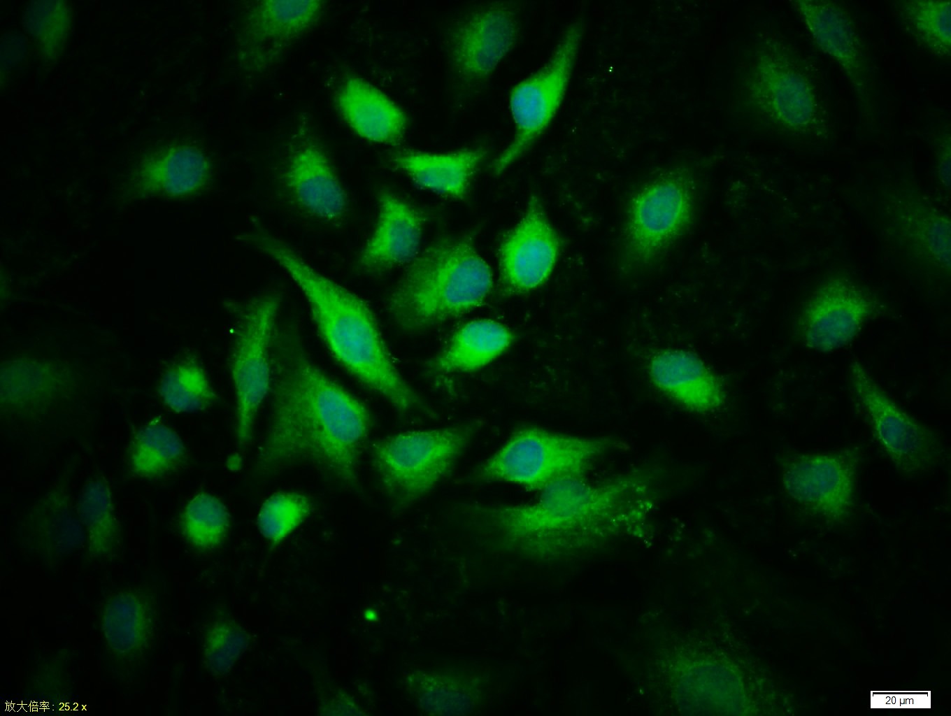 Anti-Phospho-JAK2 (Tyr1007, 1008) Polyclonal Antibody