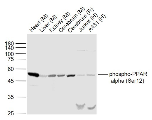 Anti-Phospho-PPAR alpha/PPARA alpha (Ser12) Polyclonal Antibody