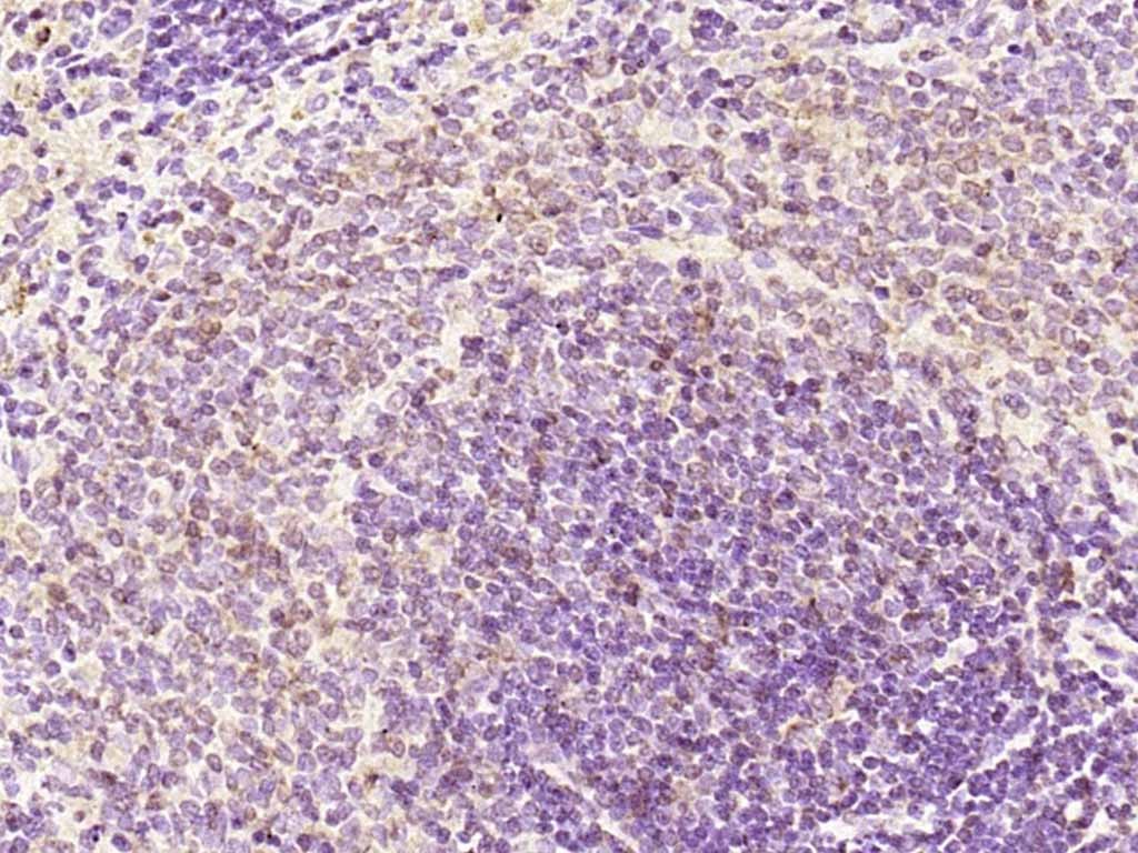 Anti-Phospho-JAK2 (Tyr1007, 1008) Polyclonal Antibody