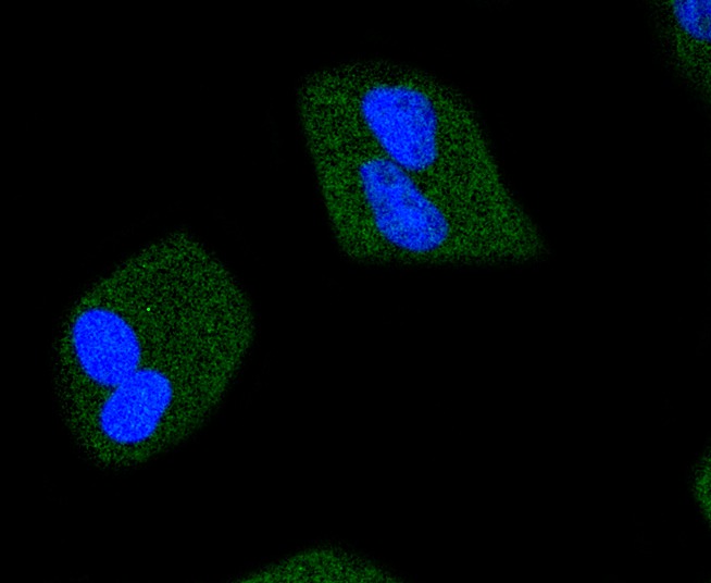 Anti-Phospho-JAK2 (Tyr1007, 1008) Antibody (2X102)