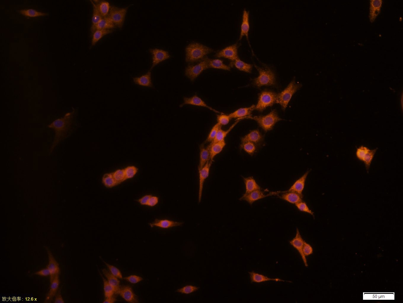 Anti-Phospho-JAK2 (Tyr1007, 1008) Polyclonal Antibody