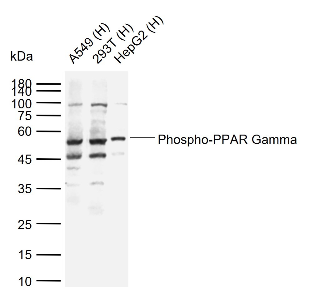 Anti-Phospho-PPAR gamma/PPARG (ser273) Polyclonal Antibody