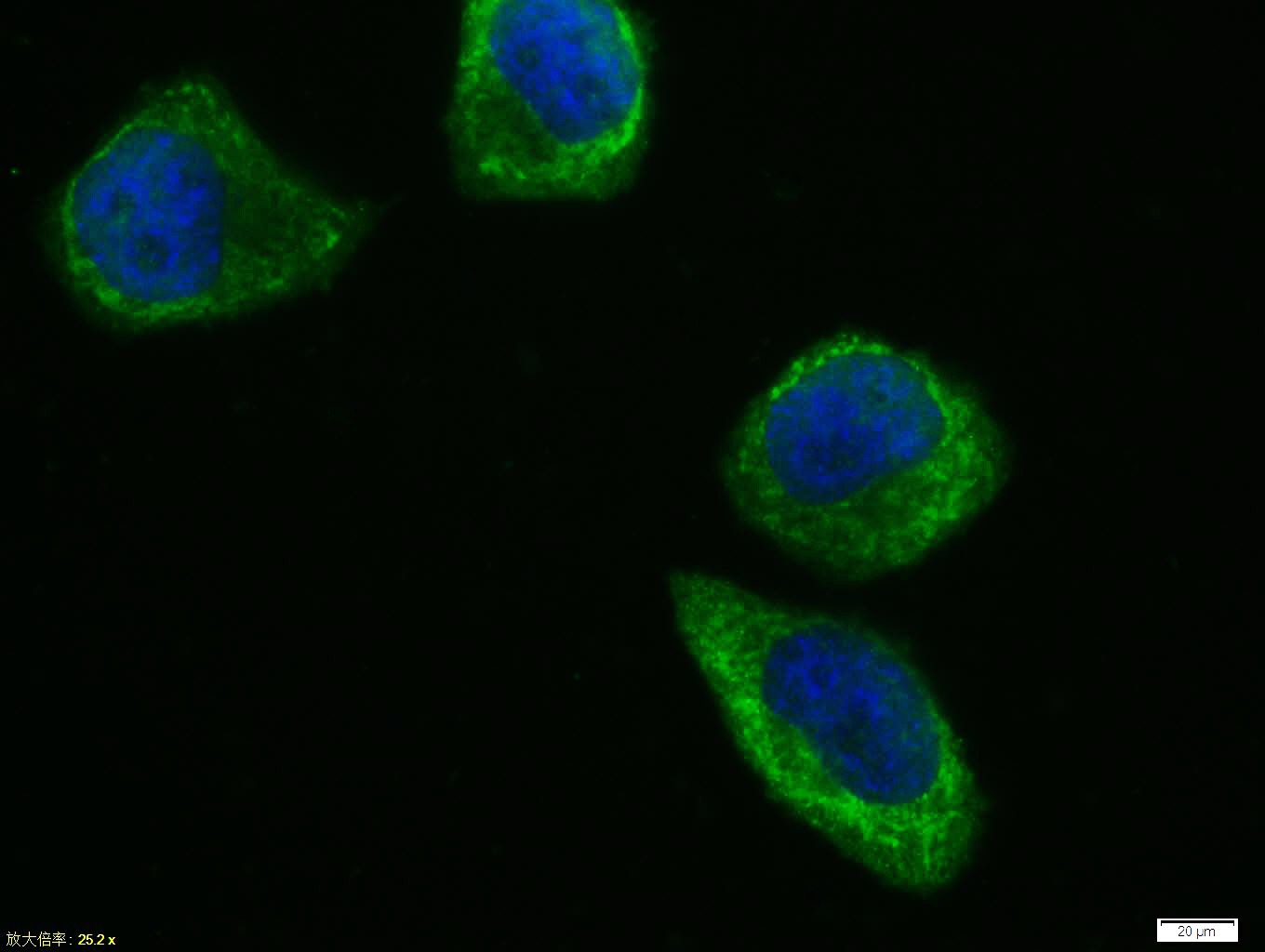 Anti-NF-kB p65 Polyclonal Antibody