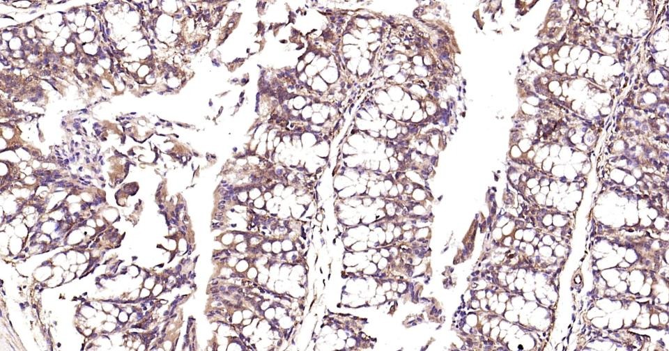 Anti-NF-kB p65 Antibody (2I809)
