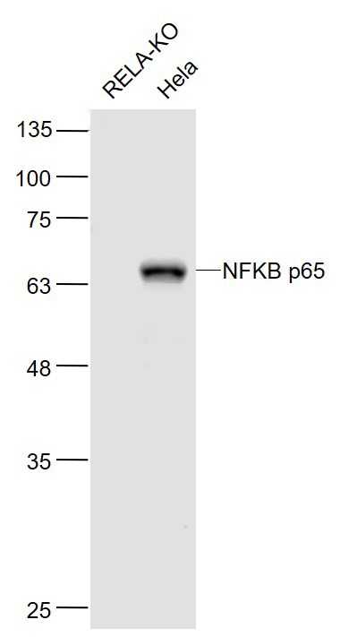 Anti-NF-kB p65 Antibody (9V807)