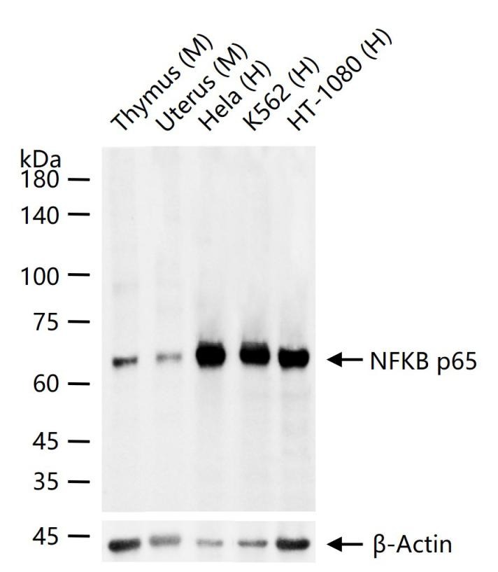 Anti-NF-kB p65 Antibody (2I809)