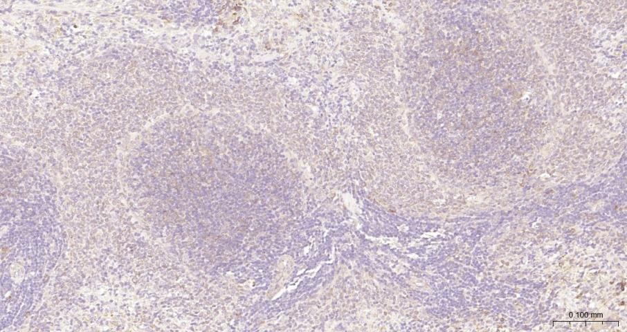 Anti-NF-kB p65 Polyclonal Antibody 3