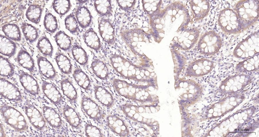 Anti-NF-kB p65 Polyclonal Antibody 3