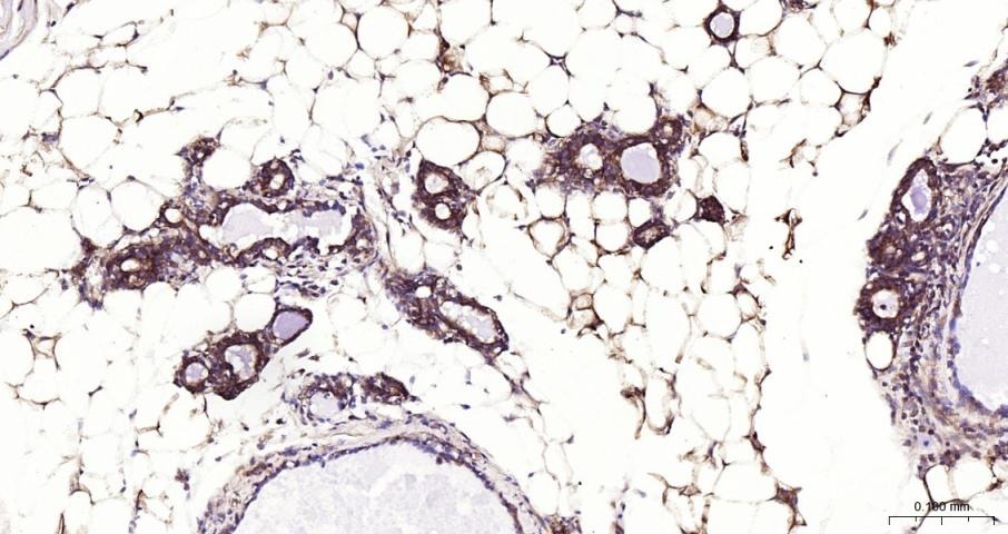 Anti-NF-kB p65 Polyclonal Antibody 3