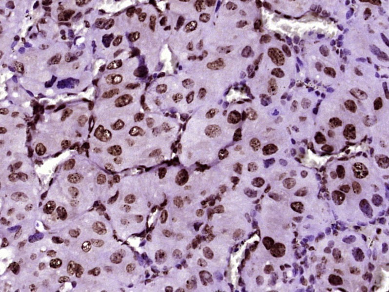 Anti-MYF5 Polyclonal Antibody