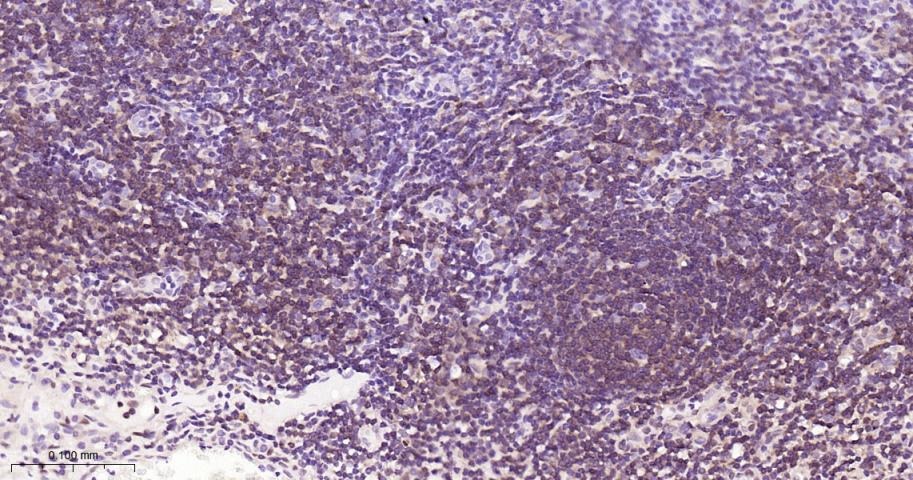 Anti-NF-kB p65 Antibody (5J938)