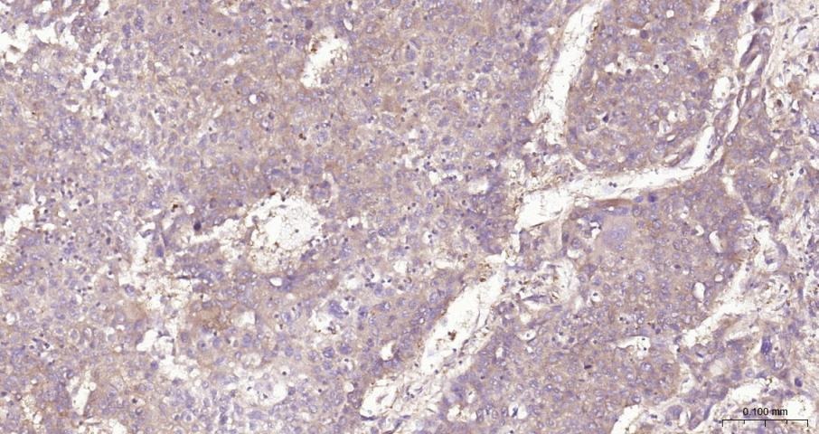 Anti-NF-kB p65 Polyclonal Antibody 3