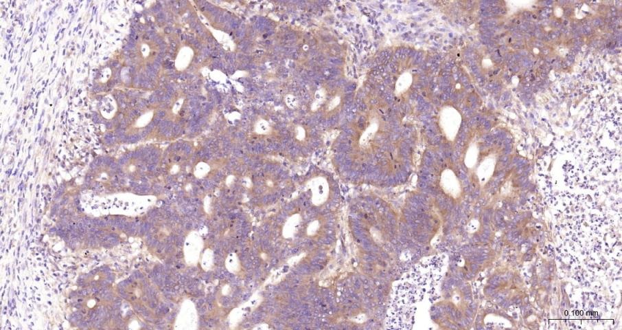 Anti-NF-kB p65 Polyclonal Antibody 3