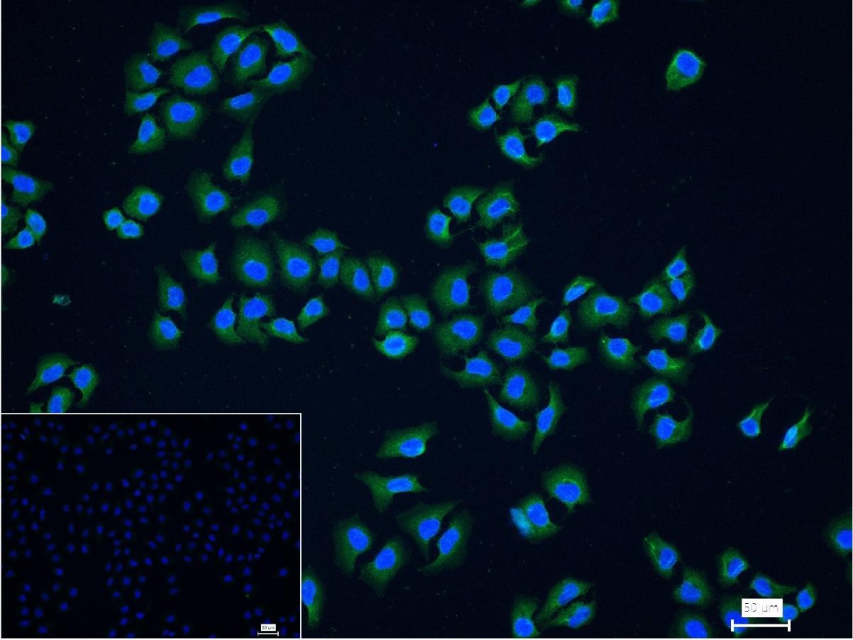 Anti-NF-kB p65 Polyclonal Antibody 3