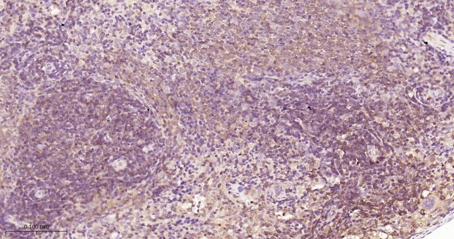Anti-NF-kB p65 Antibody (9V807)