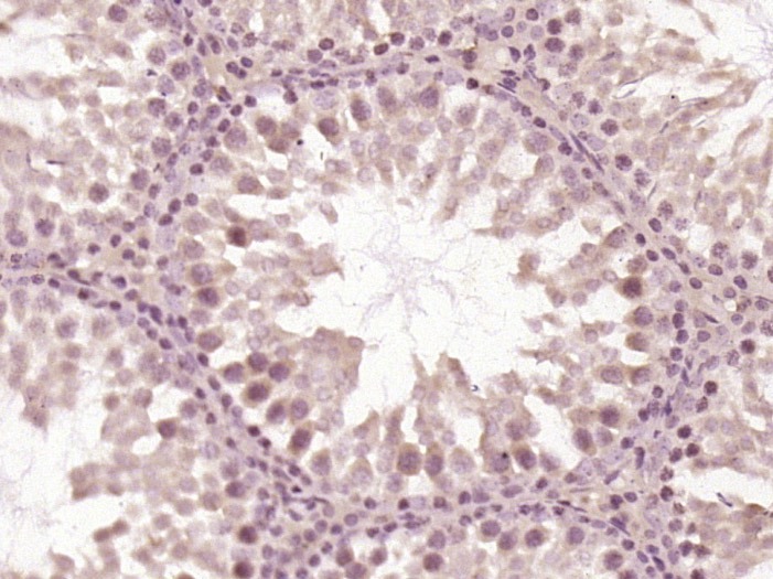 Anti-OTUD1 Polyclonal Antibody