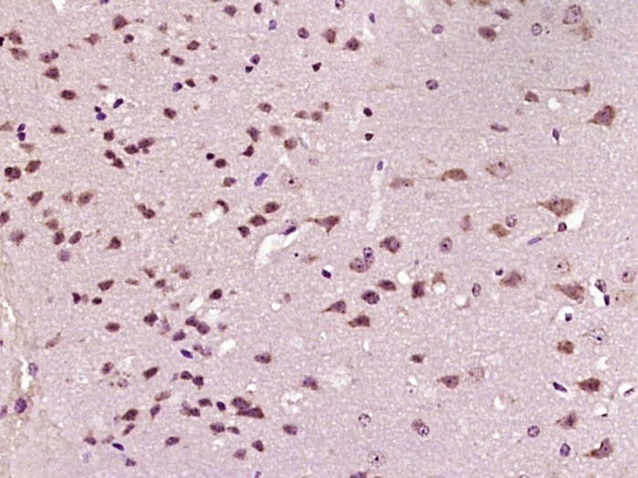 Anti-NR3C1 Polyclonal Antibody 2