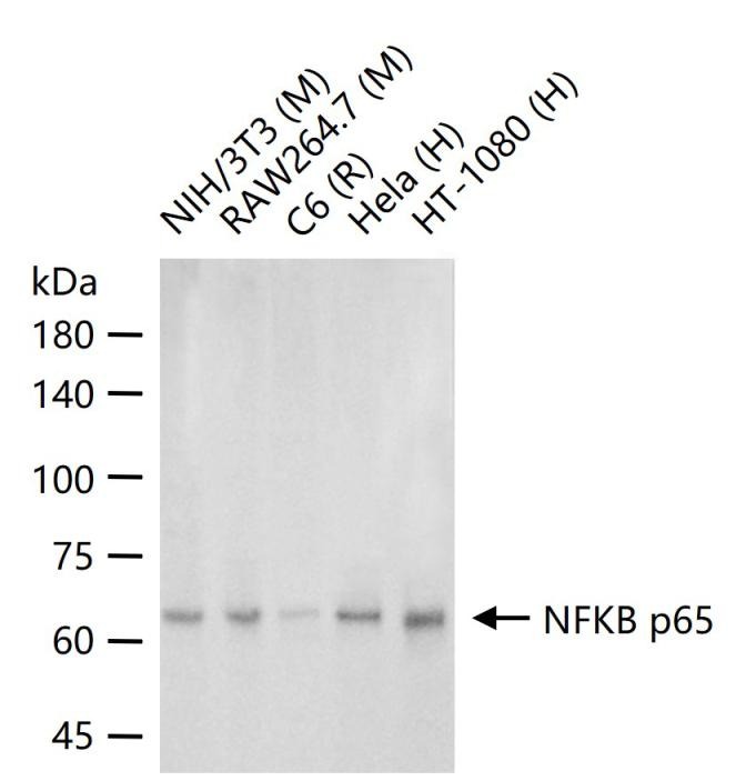 Anti-NF-kB p65 Antibody (5J938)