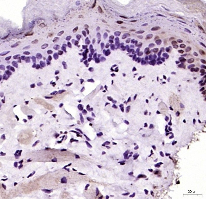 Anti-MYF5 Polyclonal Antibody