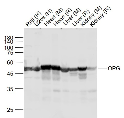 Anti-Osteoprotegerin Polyclonal Antibody 2