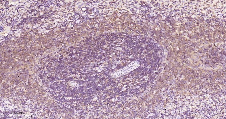 Anti-NF-kB p65 Antibody (5J938)