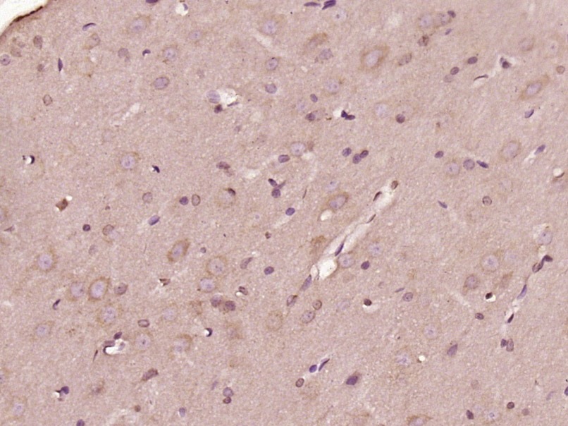 Anti-OTUD1 Polyclonal Antibody