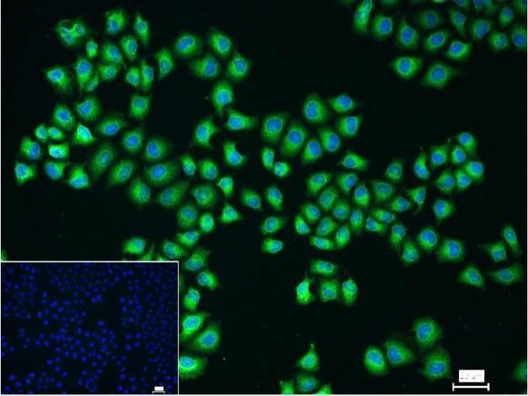 Anti-NF-kB p65 Polyclonal Antibody
