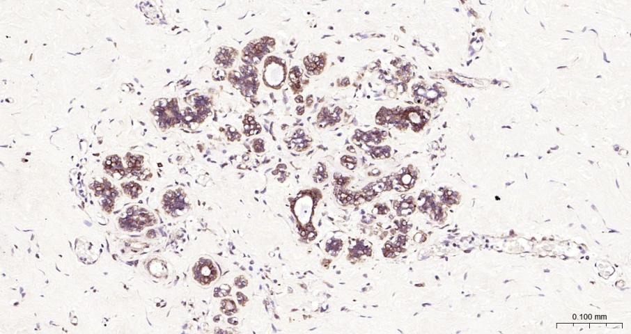 Anti-NF-kB p65 Polyclonal Antibody 3