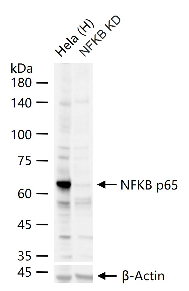 Anti-NF-kB p65 Polyclonal Antibody 3