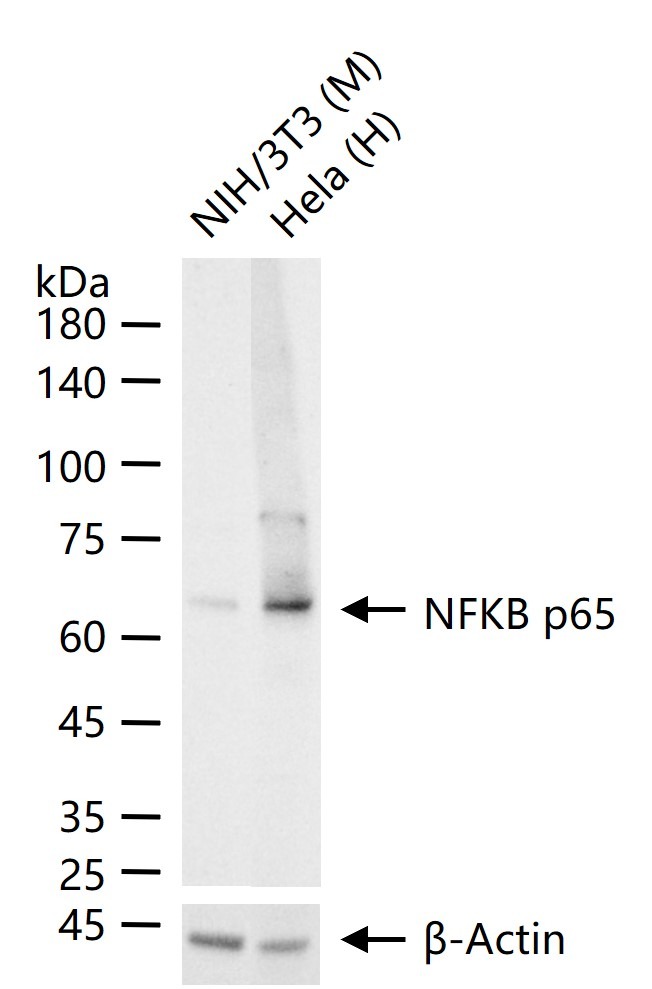 Anti-NF-kB p65 Polyclonal Antibody 3