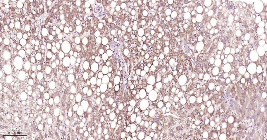 Anti-NF-kB p65 Antibody (9V807)