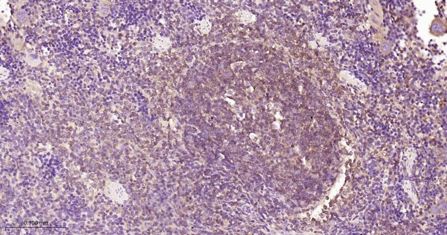 Anti-NF-kB p65 Antibody (9V807)