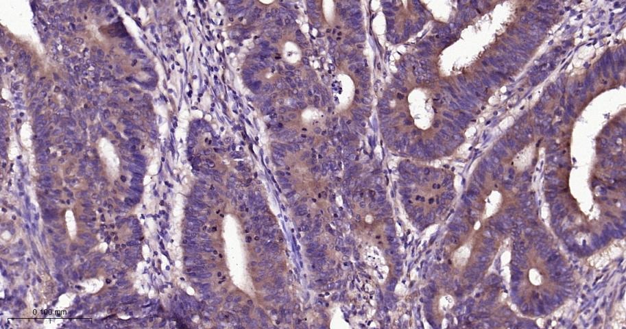 Anti-NF-kB p65 Antibody (9V807)