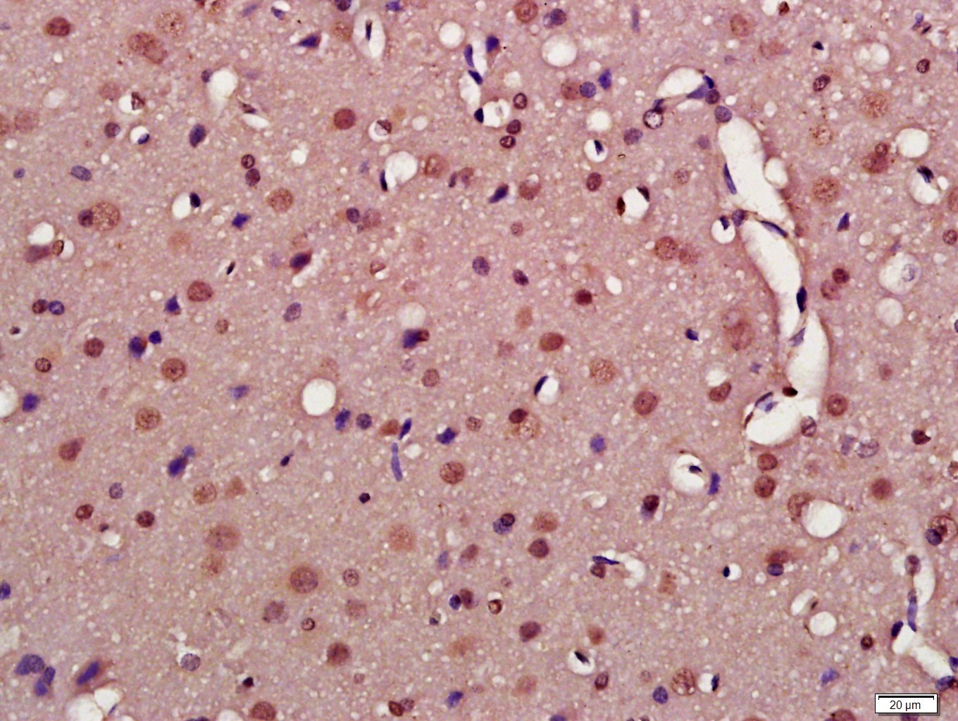 Anti-Nitro-Alpha-synuclein (Tyr39) Polyclonal Antibody