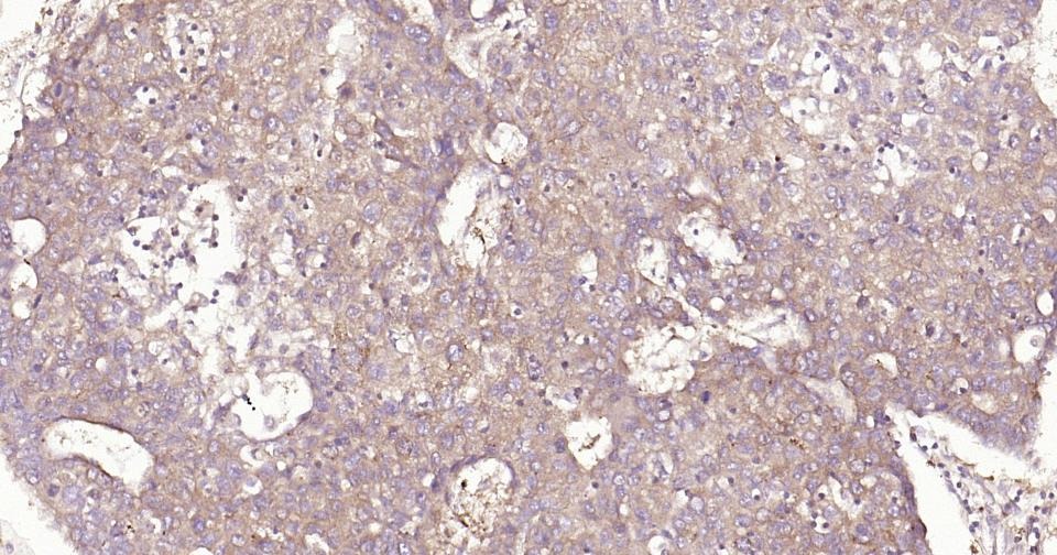 Anti-NF-kB p65 Antibody (2I809)