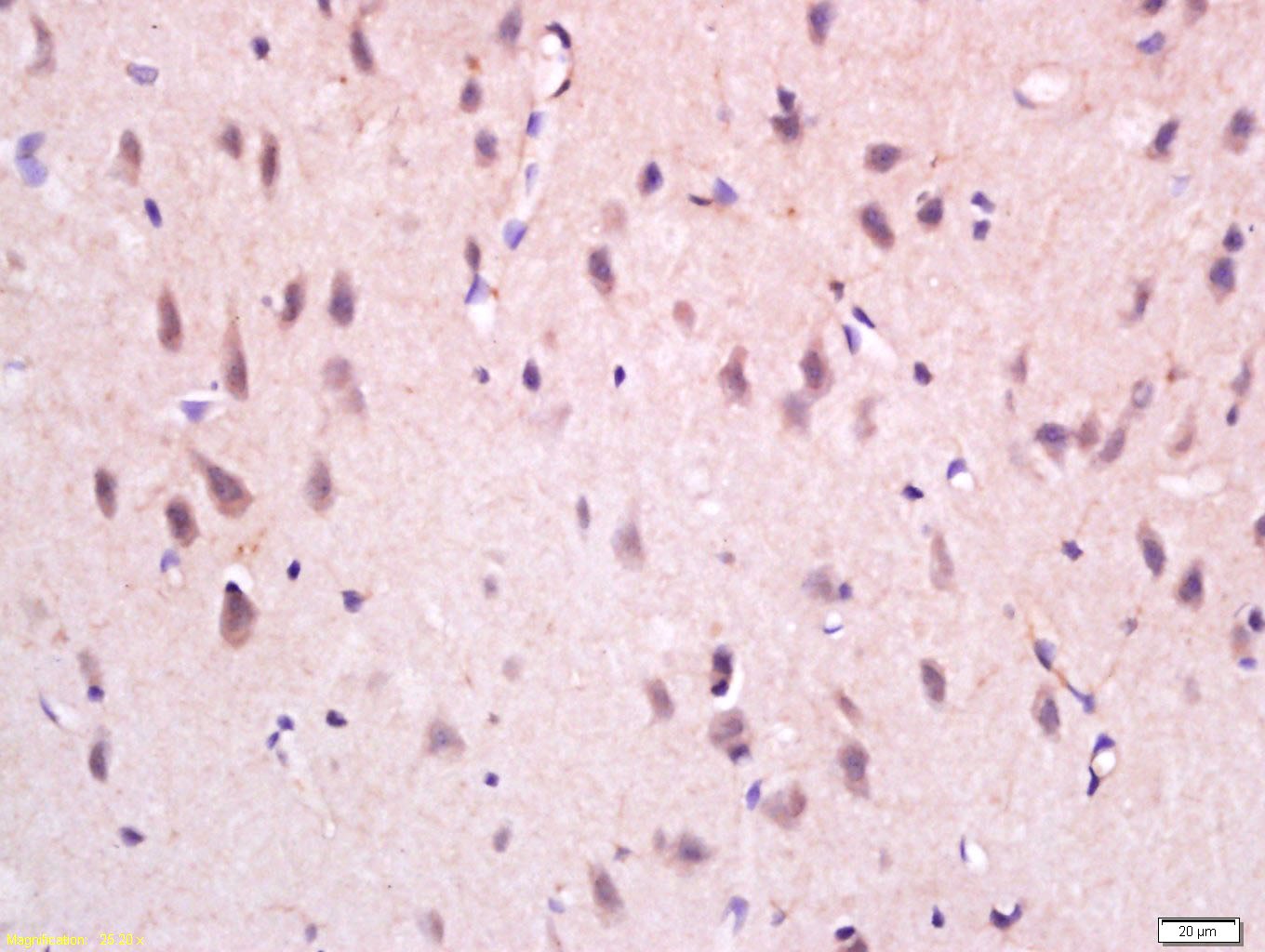 Anti-NGF Polyclonal Antibody 2