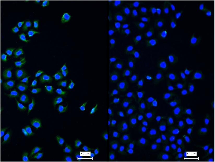 Anti-NF-kB p65 Antibody (2I809)