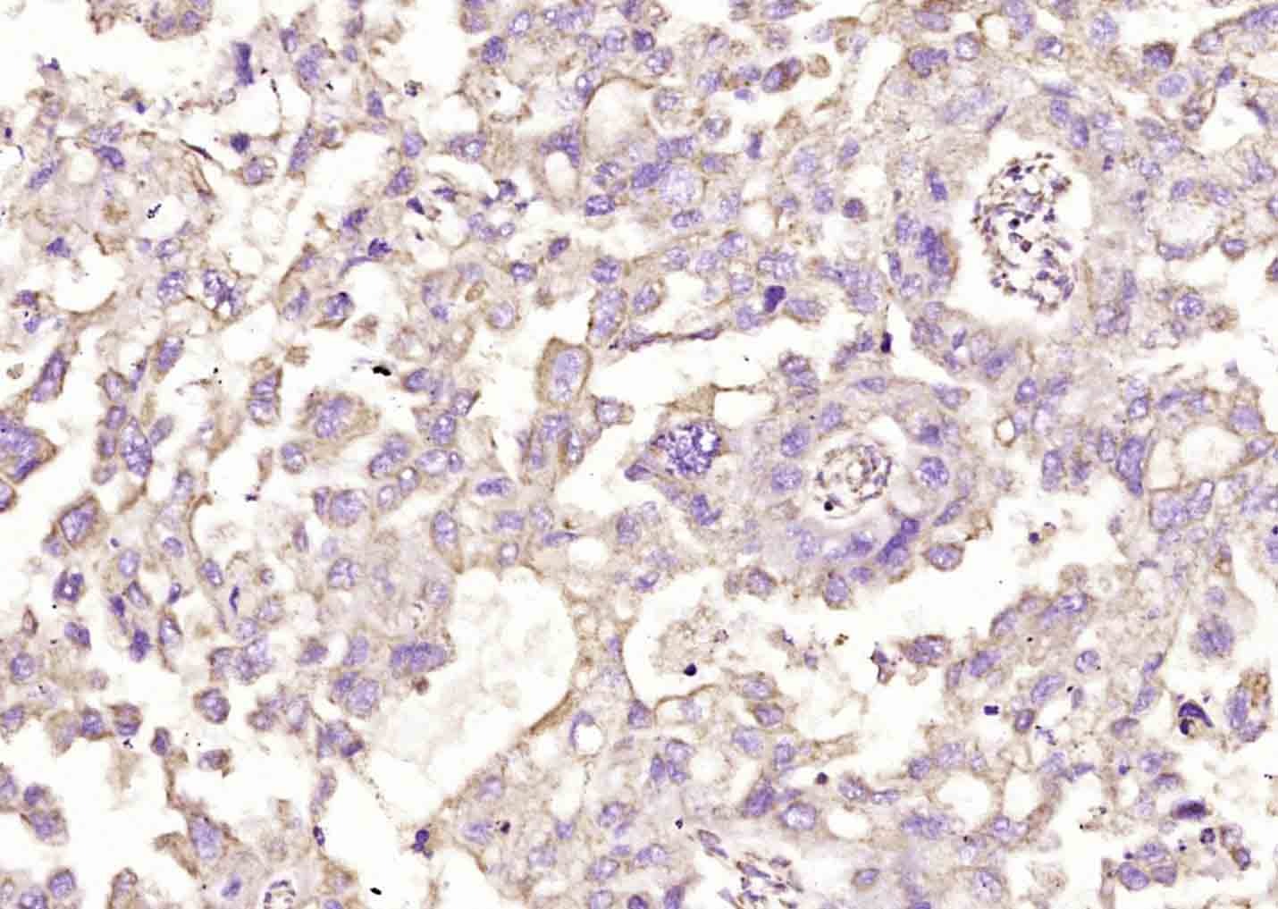 Anti-NKp46/NCR1 Polyclonal Antibody