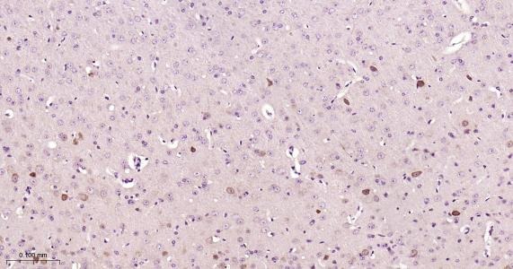 Anti-NGF Antibody (1M564)