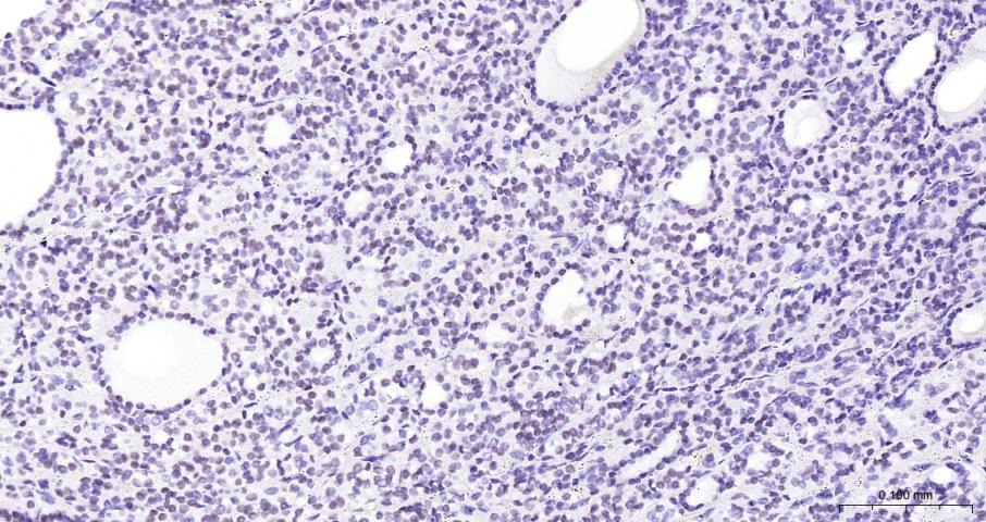 Anti-NKX2-1 Polyclonal Antibody