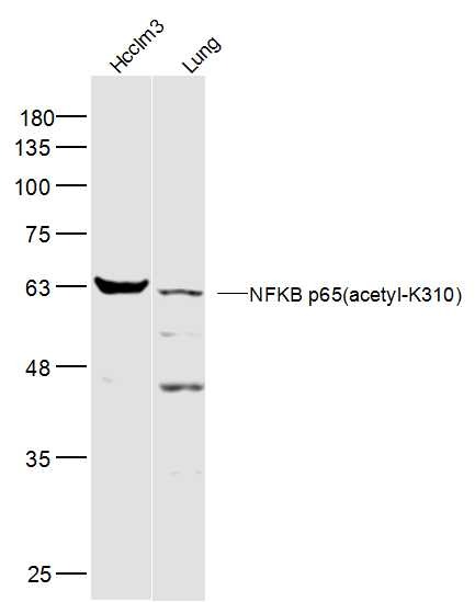 Anti-NF-kB p65 Polyclonal Antibody 6