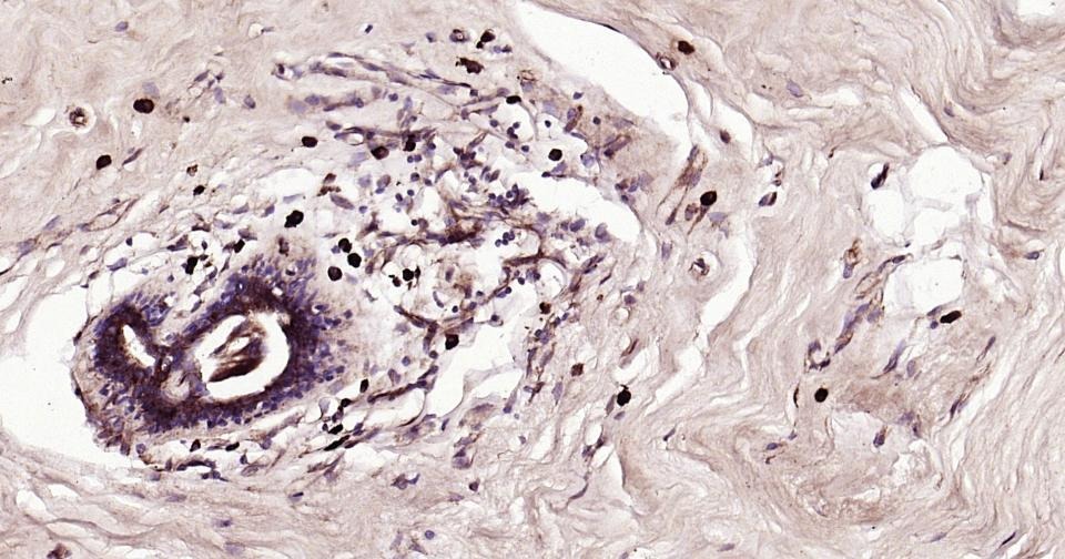 Anti-NLRP3 Polyclonal Antibody