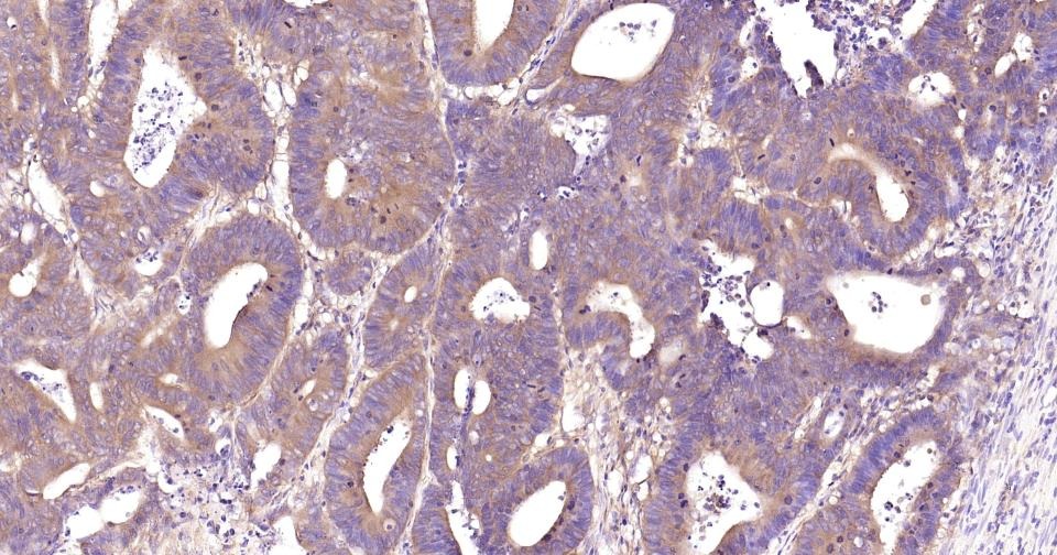 Anti-NF-kB p65 Antibody (2I809)