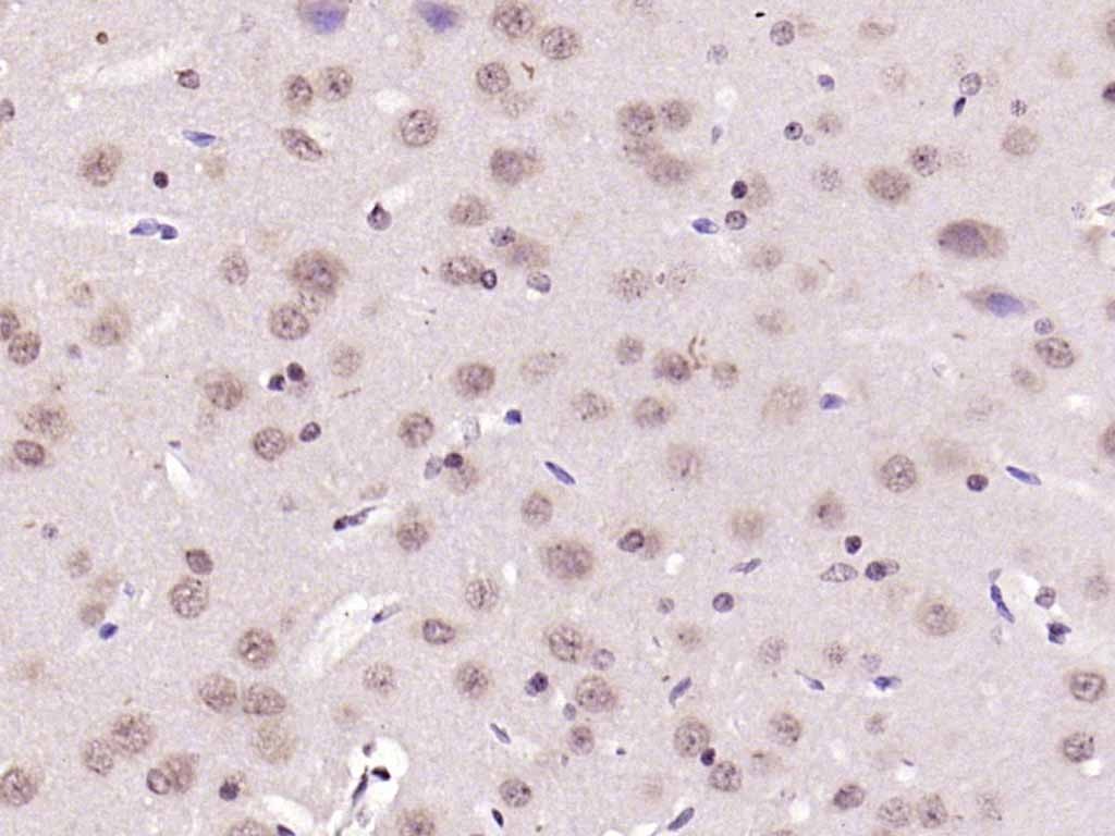 Anti-NFKB1 Polyclonal Antibody