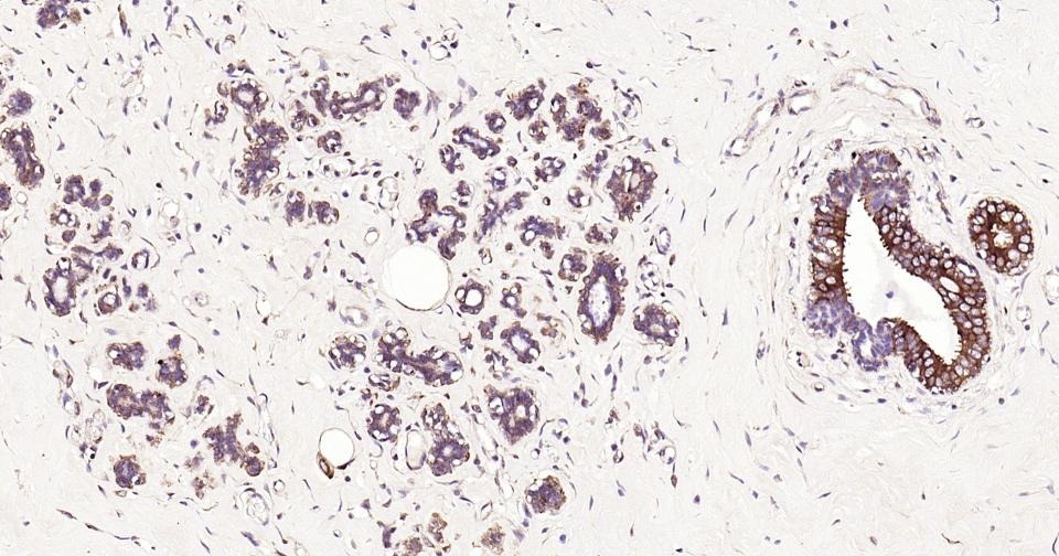 Anti-NF-kB p65 Antibody (2I809)