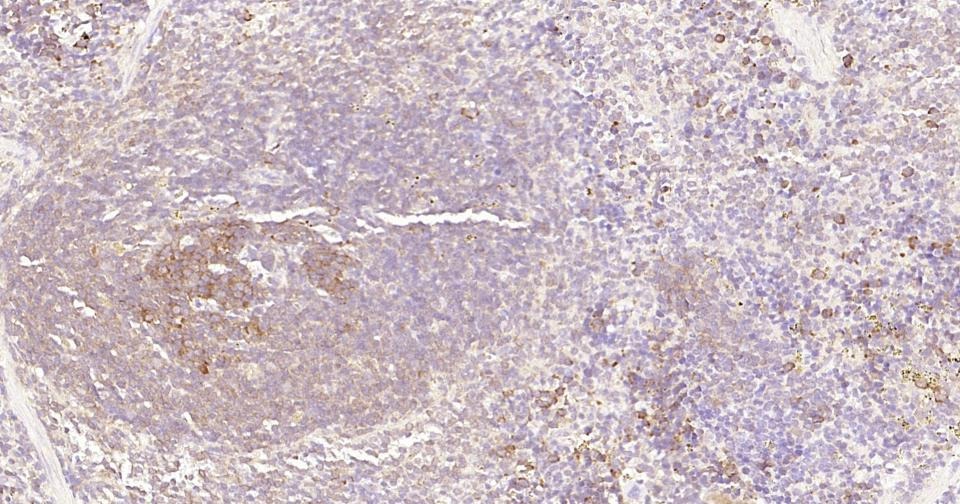 Anti-NF-kB p65 Antibody (2I809)