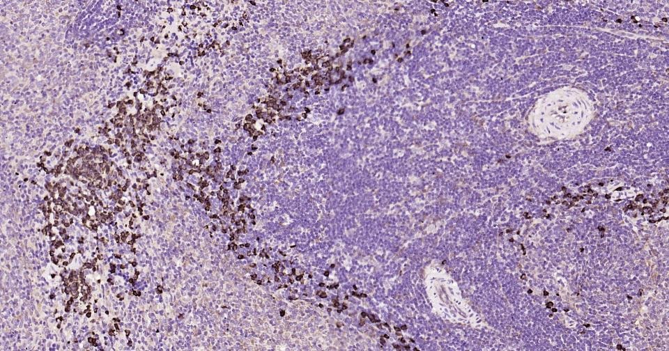 Anti-NLRP3 Polyclonal Antibody
