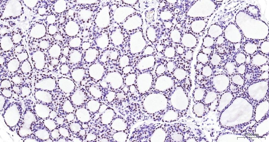Anti-NKX2-1 Polyclonal Antibody