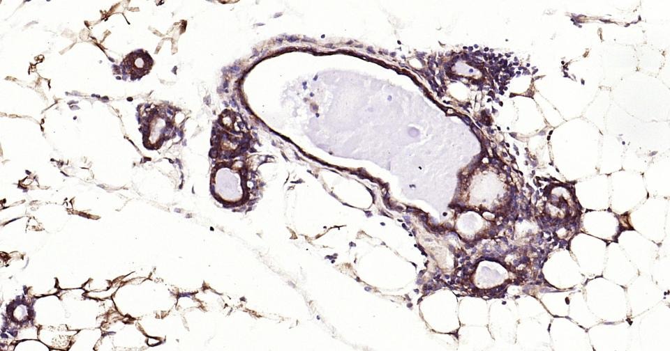 Anti-NF-kB p65 Antibody (2I809)